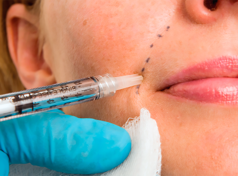 dermal_fillers_1600x900 dermal_fillers_1600x900